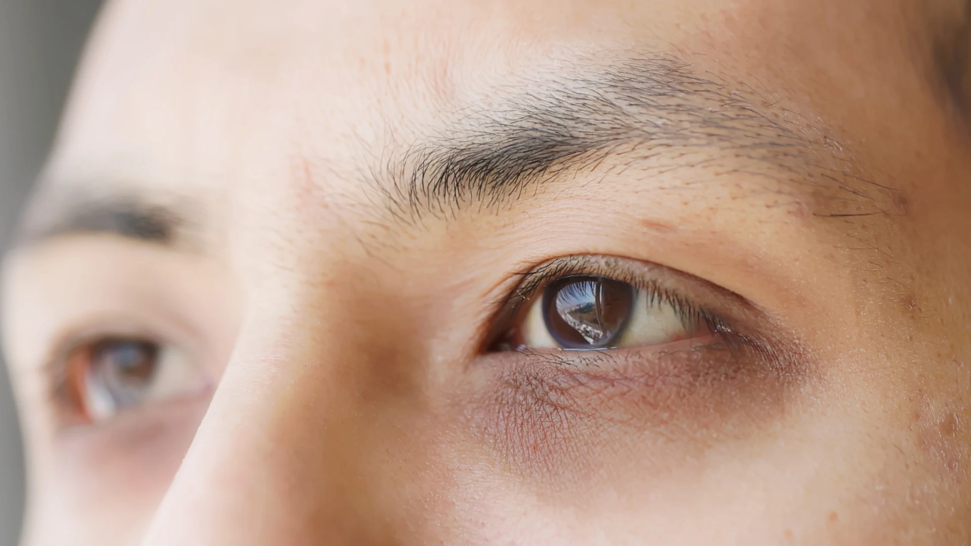 Dark Circles vs. Puffy Eyes