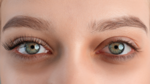 Reduce Dark Circles