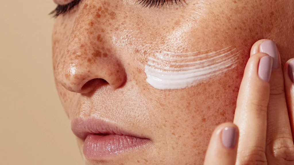Dark spots