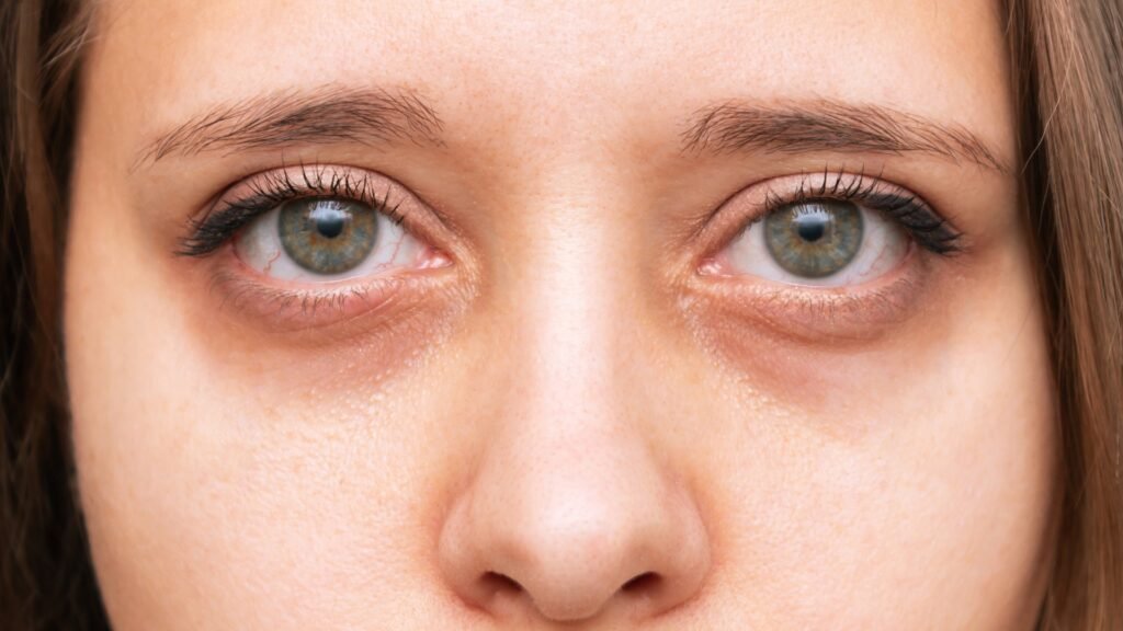 Under-Eye Cream