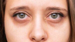 Under-Eye Cream