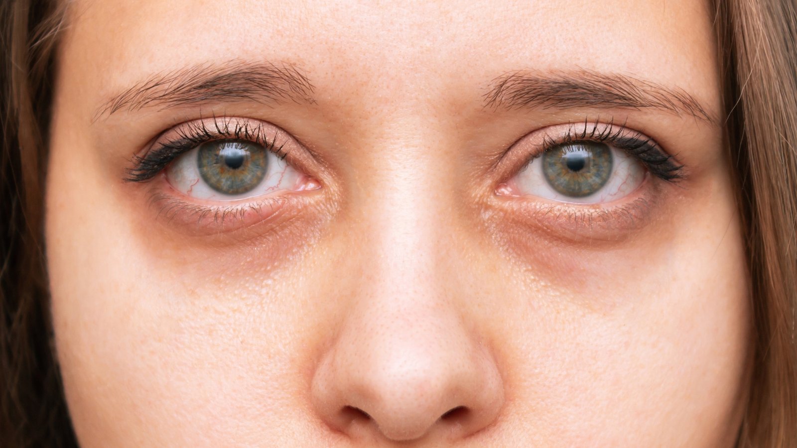 Under-Eye Cream