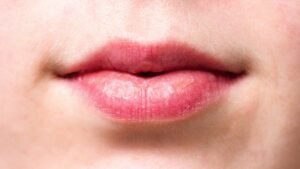 Pigmented Lips
