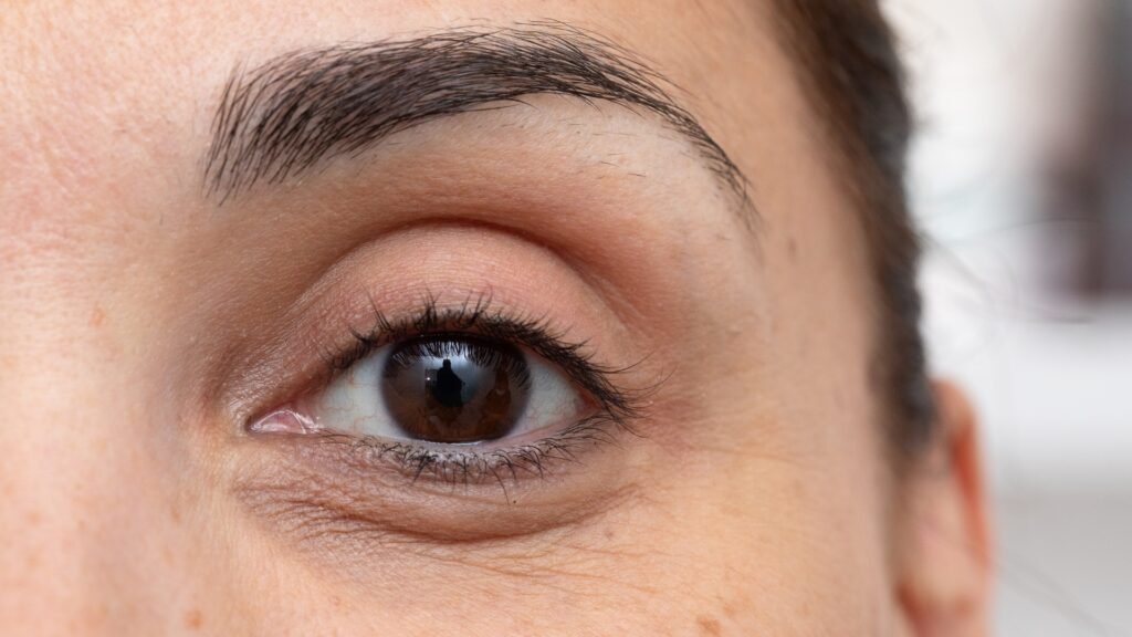 Eye Cream