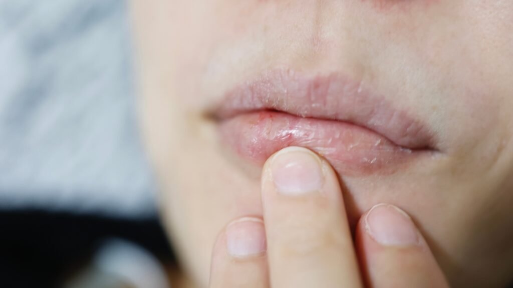 Lip Balm for Winter