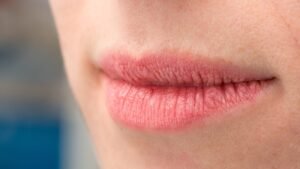 Lip Balm for Winter